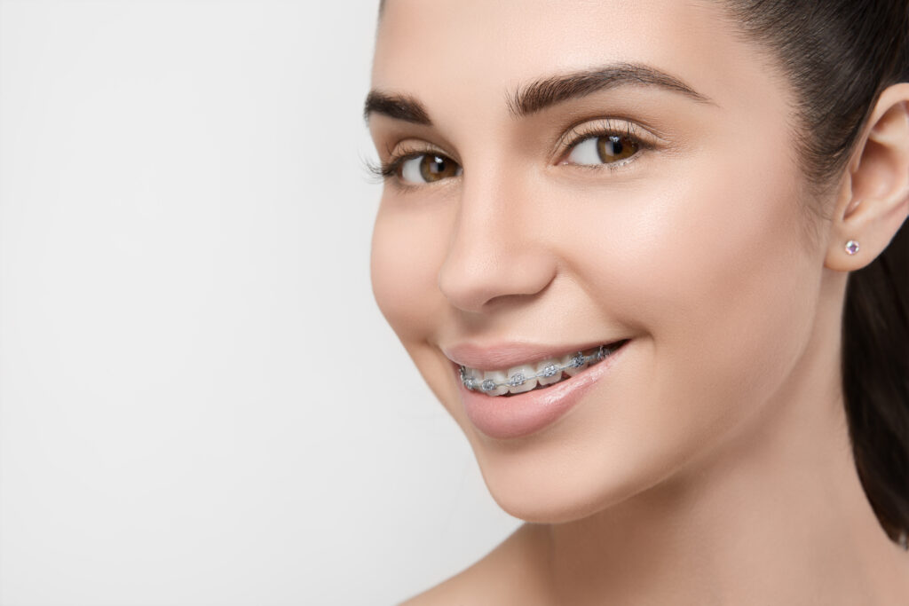 The benefits of wearing braces | Berwick | South East Orthodontics